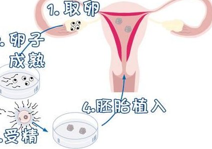 2026年广州试管三代试管医院推荐 附试管费用明细