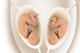 马来西亚第三代试管婴儿总费用多少钱？